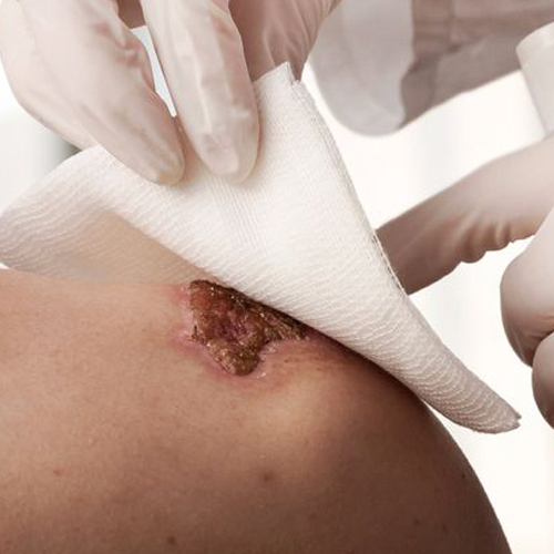 Cura de heridas