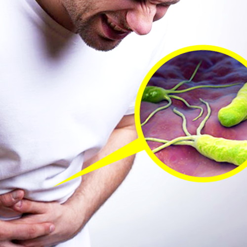H-Pylori